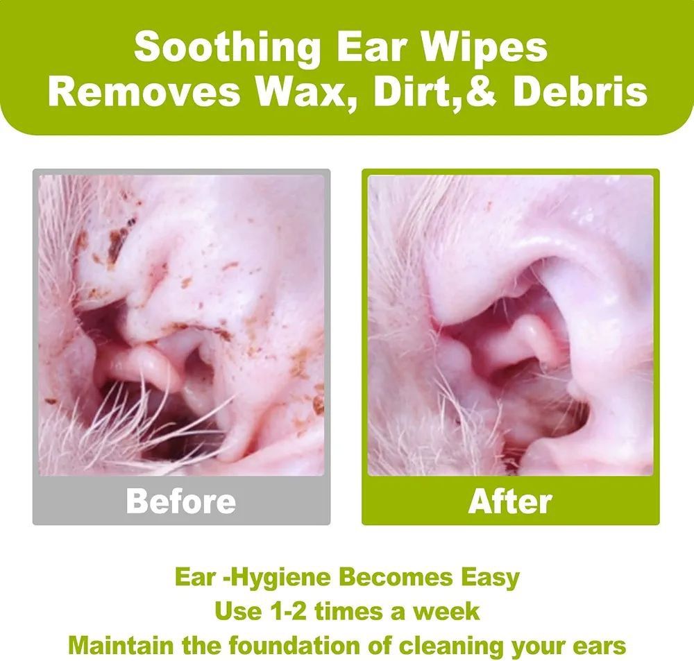 Dr.Easy تنظيف الاذن